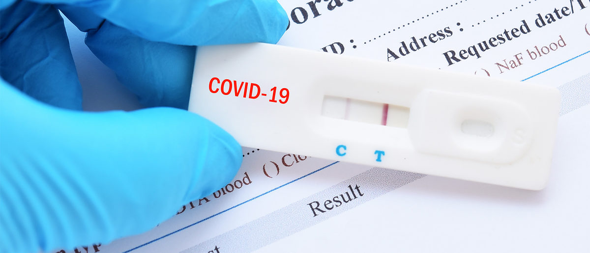 coronatest