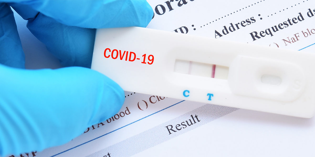 coronatest