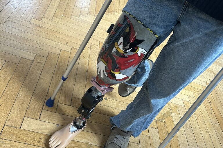Eine Schülerin mit einer Fußprothese des Sanitätshaus Andreas Fritzsch.